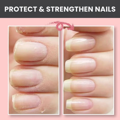 EverNail™ | Nail Repair Protection Gel
