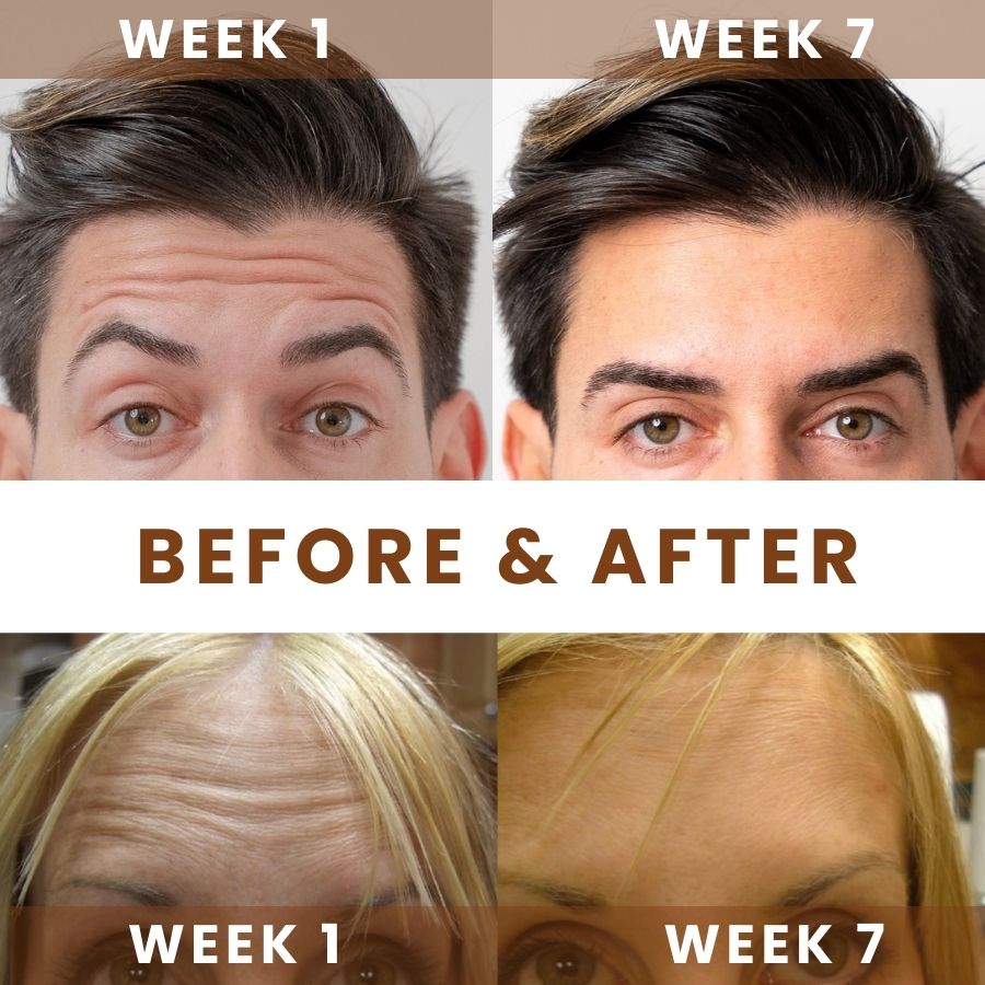 AgeGlow™ |  Anti-Aging Retinol Cream