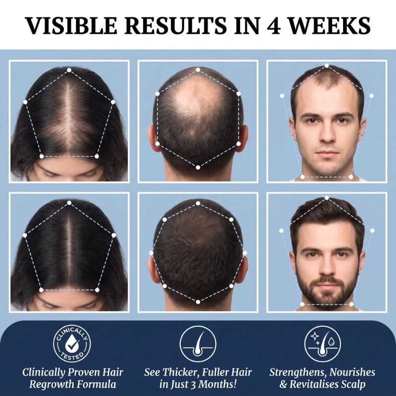 HairBooster™ | Hair Growth Roll on Serum