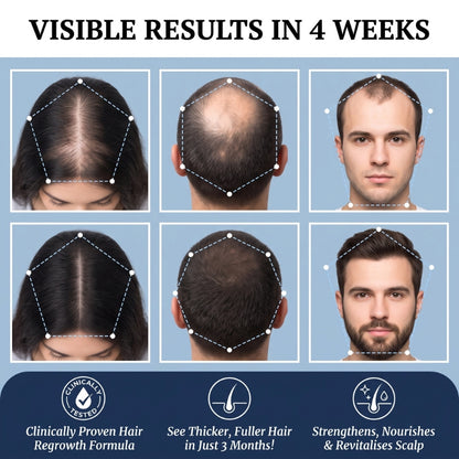 HairBooster™ | Hair Growth Roll on Serum