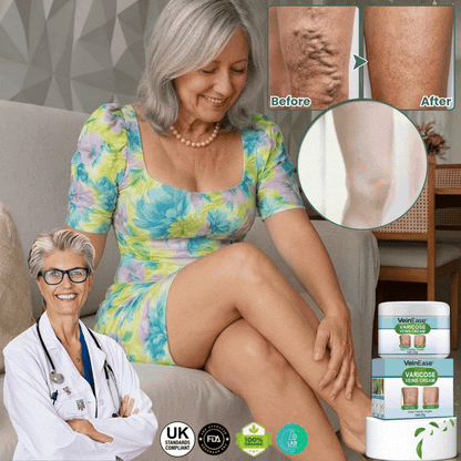 VeinEase™ | Varicose Veins Cream