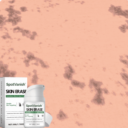 SpotVanish™ | Immediate Mole & Spot Cream