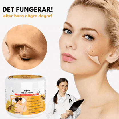 HudKlar™ | Bli av med irriterande hudvårtor på bara 7 Dagar!