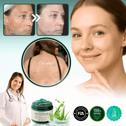 PerfectSkin™ | Instant Mole & Spot Removal Gel