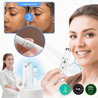 LaserPen™ | Precision Plasma Skin Corrector