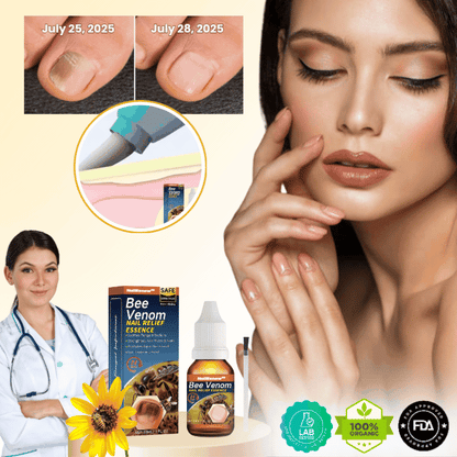NailRenew™ | Antifungal Nail Renewal Oil