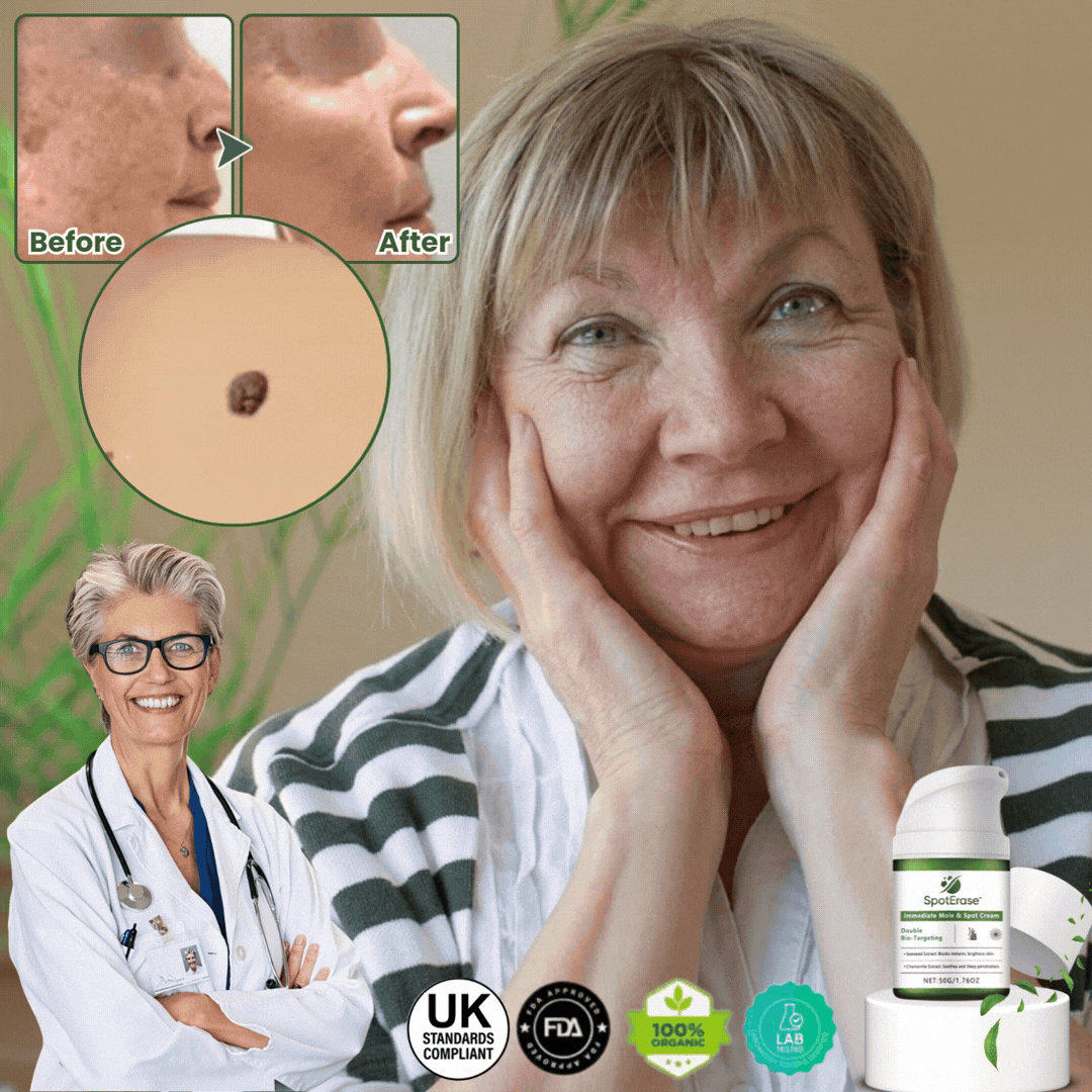 SpotErase™ | Wart Remover Cream