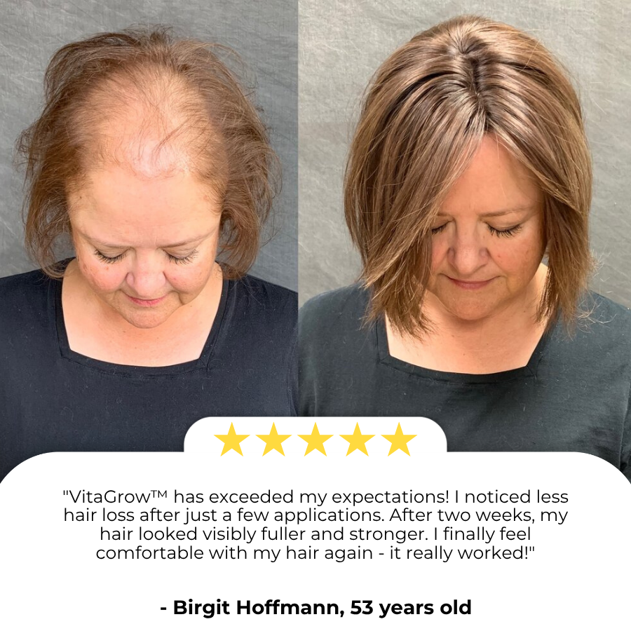 VitaGrow™ Spray | Stop hair loss and regrow up to 99% of your hair in just 2-3 weeks!