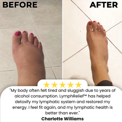 LymphRelief™ | Relieve Swelling in Just 15 Minutes!