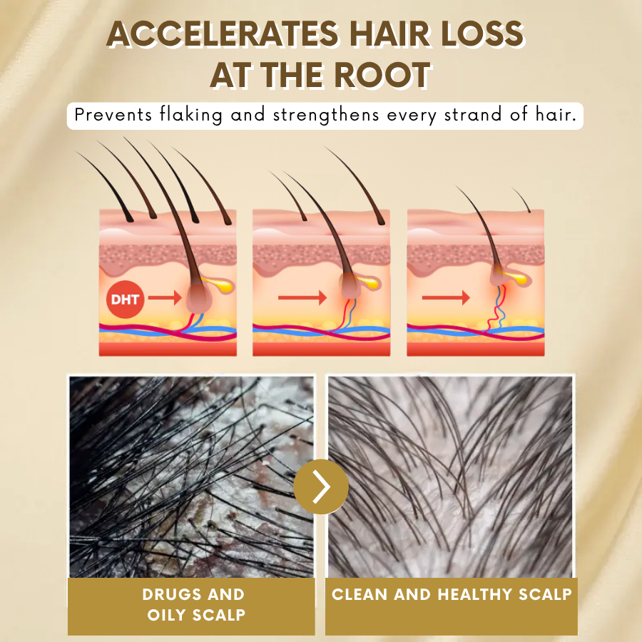 VitaGrow™ Spray | Stop hair loss and regrow up to 99% of your hair in just 2-3 weeks!
