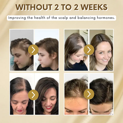 VitaGrow™ Spray | Stop hair loss and regrow up to 99% of your hair in just 2-3 weeks!