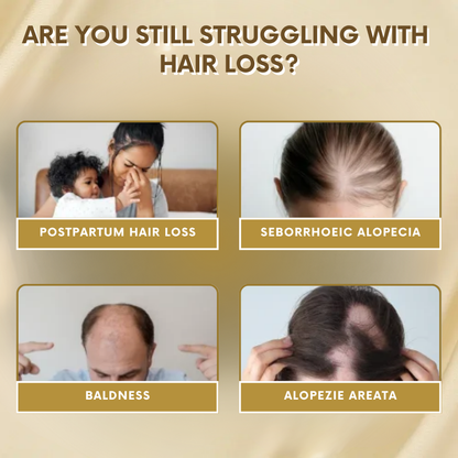 VitaGrow™ Spray | Stop hair loss and regrow up to 99% of your hair in just 2-3 weeks!