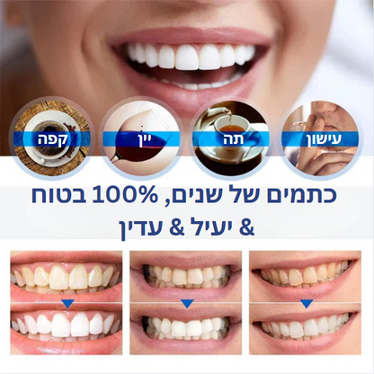 SmileGlow™ | שיניים לבנות וזוהרות תוך 3 שניות בלבד!