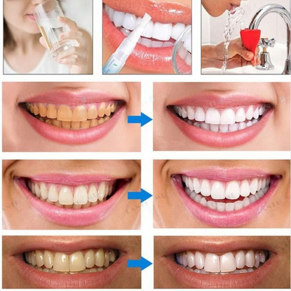 SmileGlow™ | שיניים לבנות וזוהרות תוך 3 שניות בלבד!