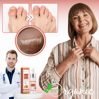 ToeCare™ | Nail Fungal Treatment Drop