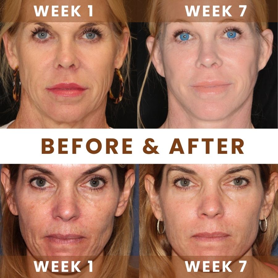 AgeGlow™ |  Anti-Aging Retinol Cream