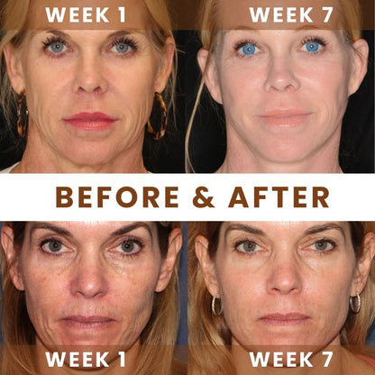 AgeGlow™ |  Anti-Aging Retinol Cream